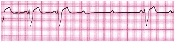 Cardiac rhythm interpretation test 10-min